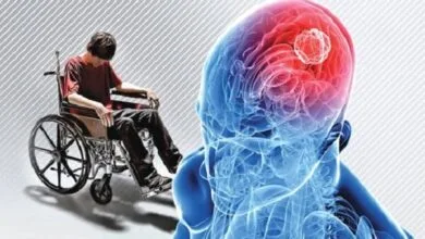 ۱۲۰ هزار بیمار «ام‌اس» در کشور؛ بیمه کدام خدمات را پوشش می‌دهد؟