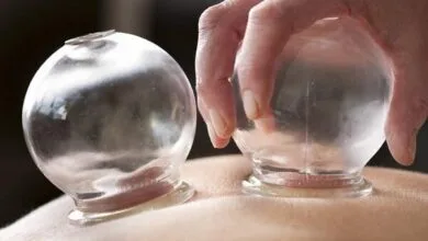 حجامت باعث لاغری و افزایش قد میشود؟ حجامت باعث لاغری و افزایش قد میشود؟
