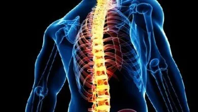 سبک زندگی سالم از بروز مشکلات ستون فقرات جلوگیری می‌کند