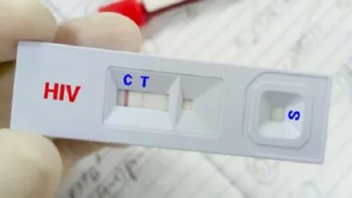 درمان «ایدز» رایگان است/ ویروس HIV قابل کنترل است به شرط درمان