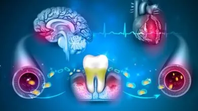 ویدیو/ آیا باکتری‌های دهان بر زوال عقل تاثیر دارند؟