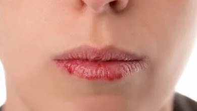 چگونگی محافظت از پوست در رمضان و پیشگیری از خشکی و ترک لب‌ها