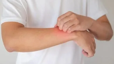 تغییر فصل، محرک اگزماست نه عامل ایجاد آن تغییر فصل، محرک اگزماست نه عامل ایجاد آن