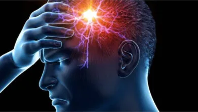 آب و هوا می‌تواند بر سردردهای میگرنی تاثیر بگذارد