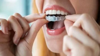 مرتب کردن دندان بدون ارتودنسی